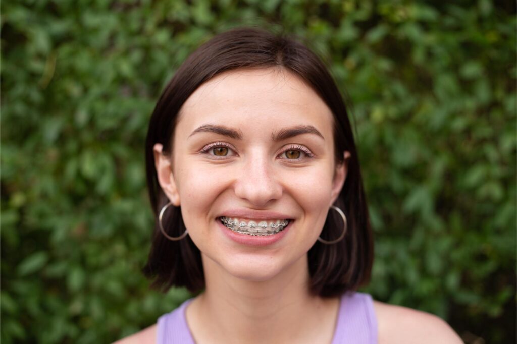 What Can I Eat With Braces? A Complete Food Guide